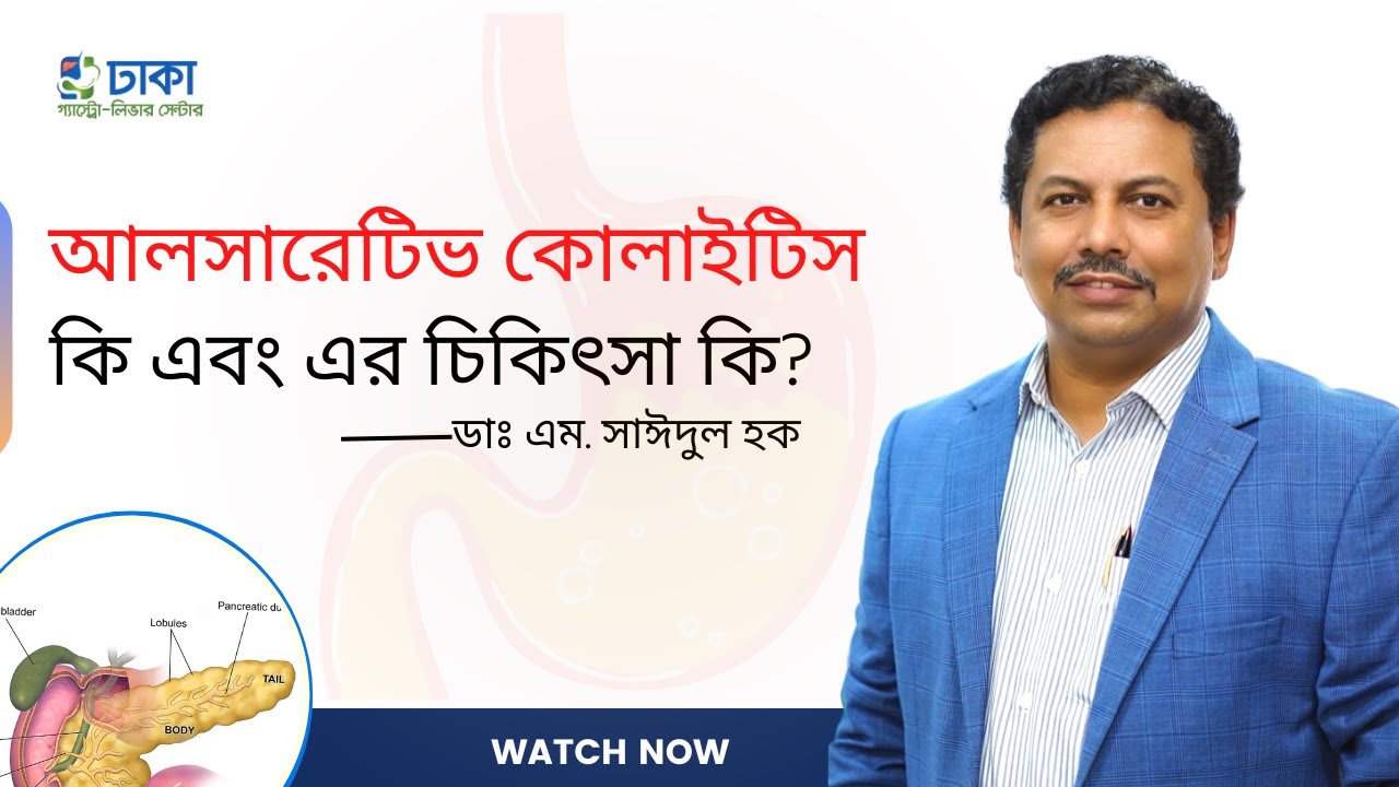 আলসারেটিভ কোলাইটিস কি এবং এর চিকিৎসা কি ? - ডাঃ এম. সাঈদুল হক