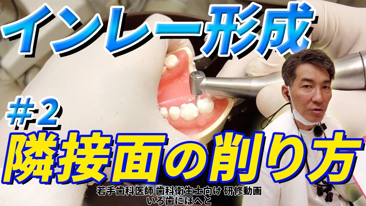 【左下7番（大臼歯）のインレー形成#2】隣接面を削る際に注意するポイント