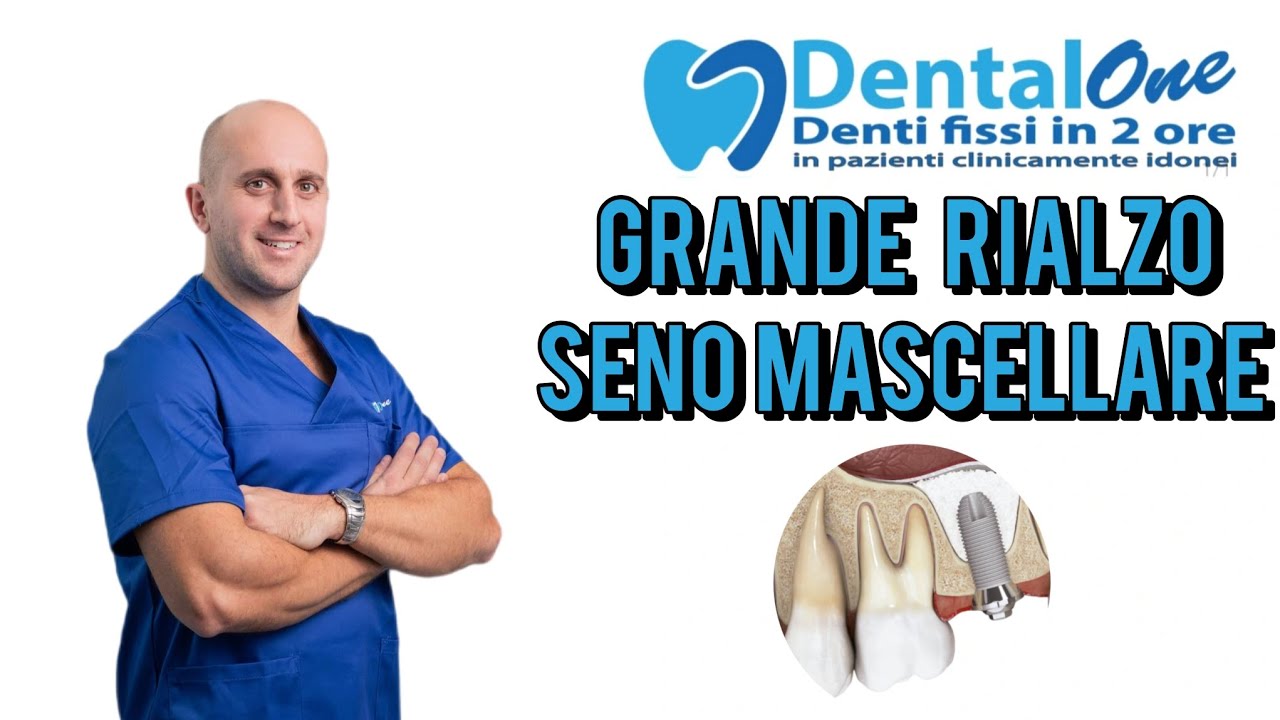 INTERVENTO GRANDE RIALZO SENO MASCELLARE #dentista #genova #dentalone