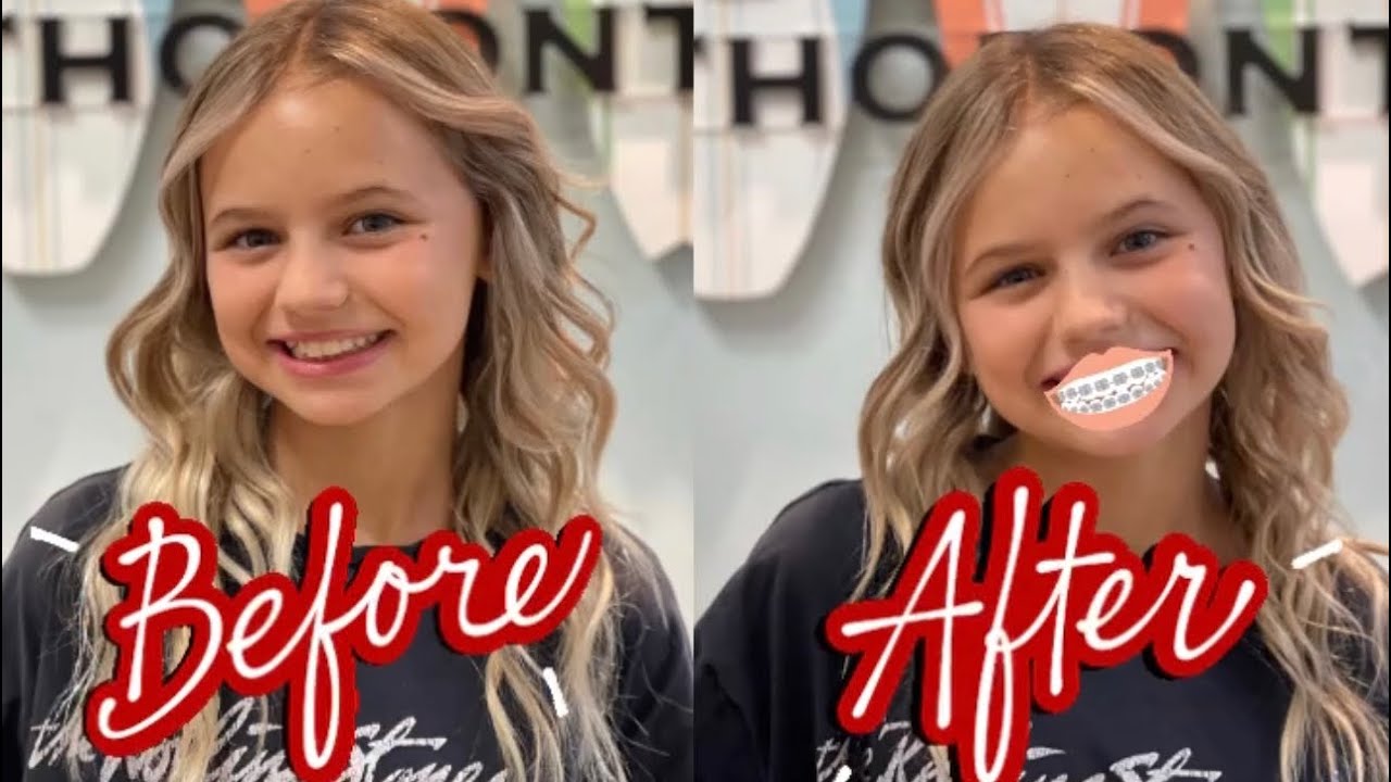 Perri Gets Braces | The LeRoys