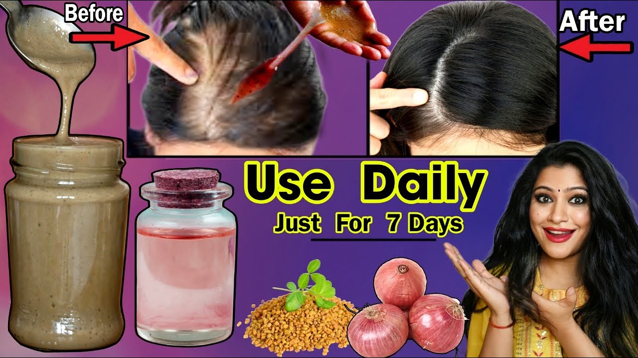 I Used Daily For 7 Days & It Regrow My Hair Quickly:Get Thick Hair Permanently & Regrow Lost Hair.