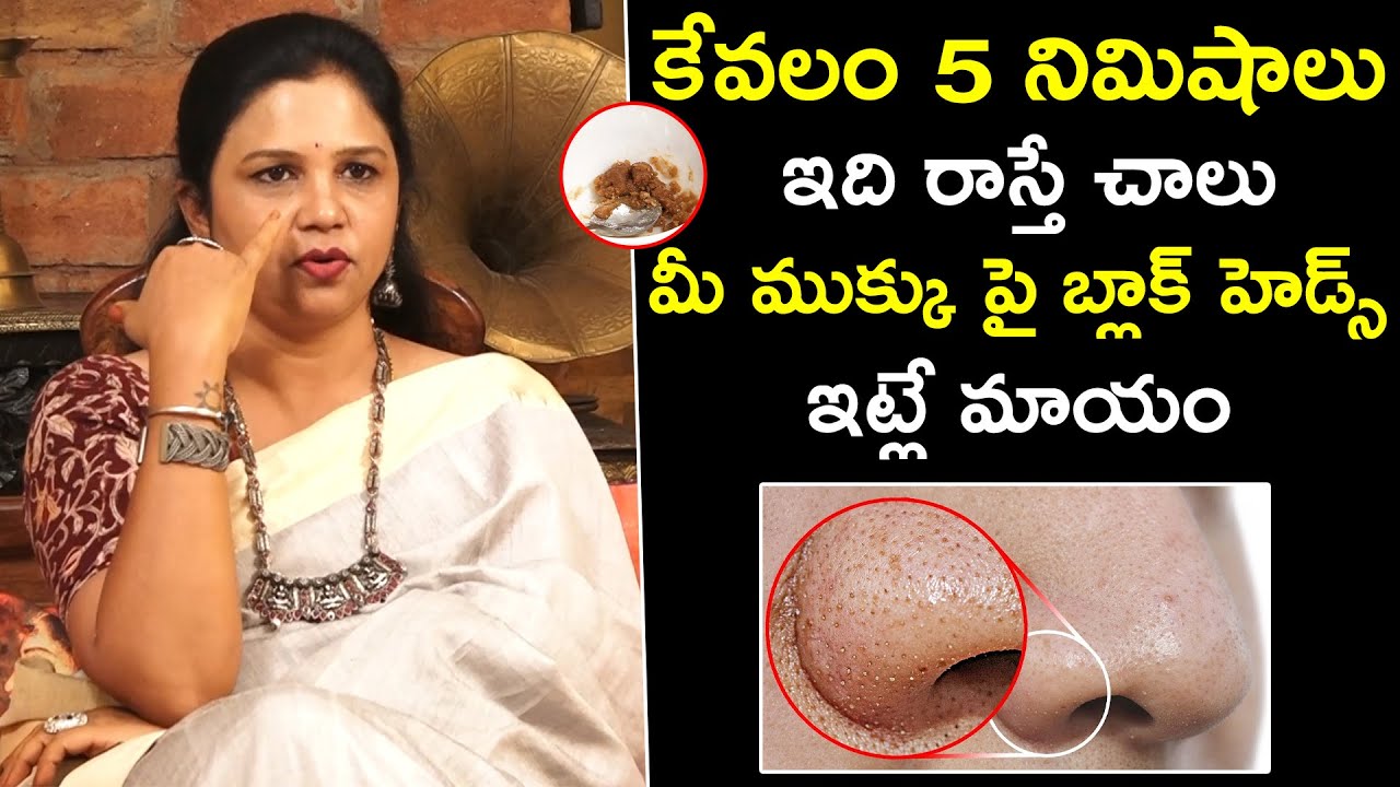 How to Remove Blackheads on Nose | Vanaja Ramishetti | Qube TV Health