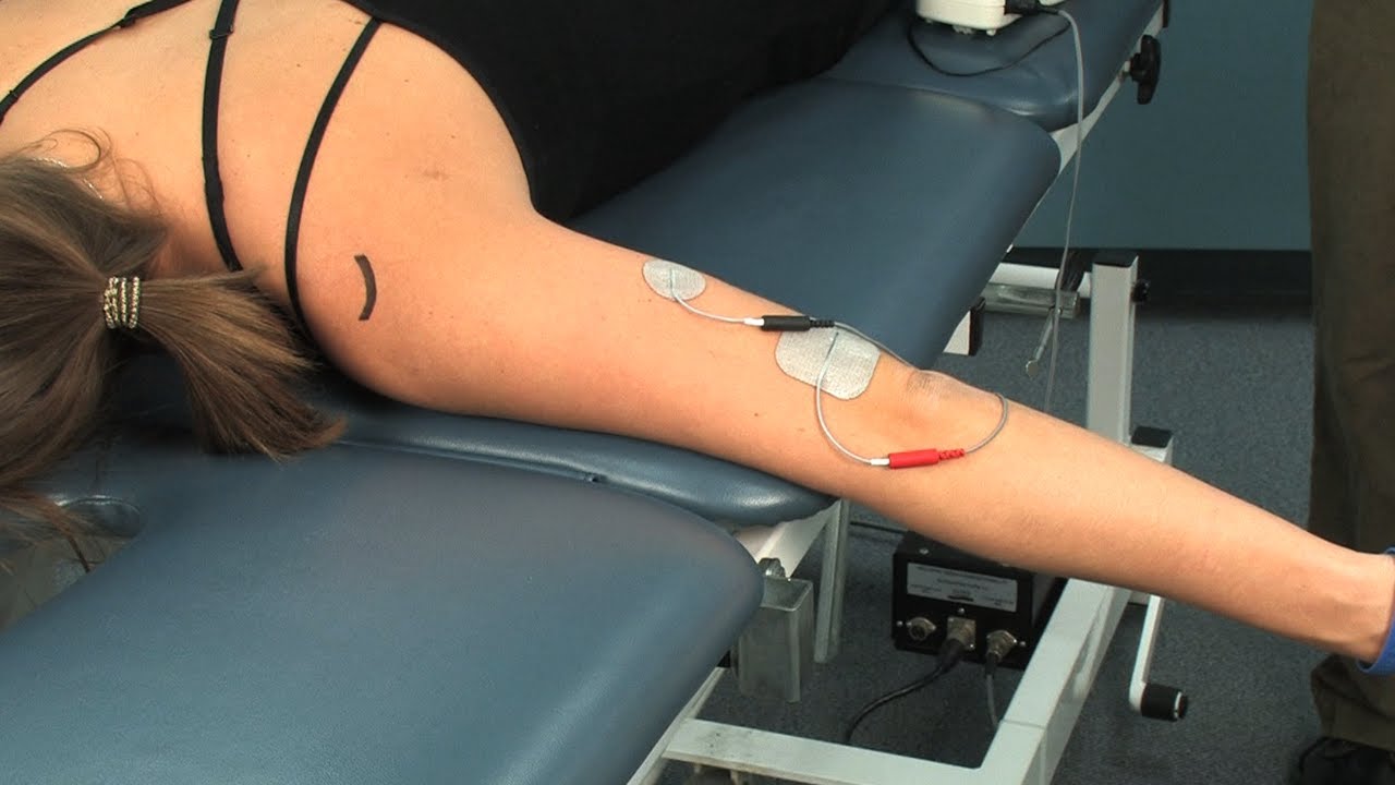 Elbow Extension Muscle Stimulation (EMS)