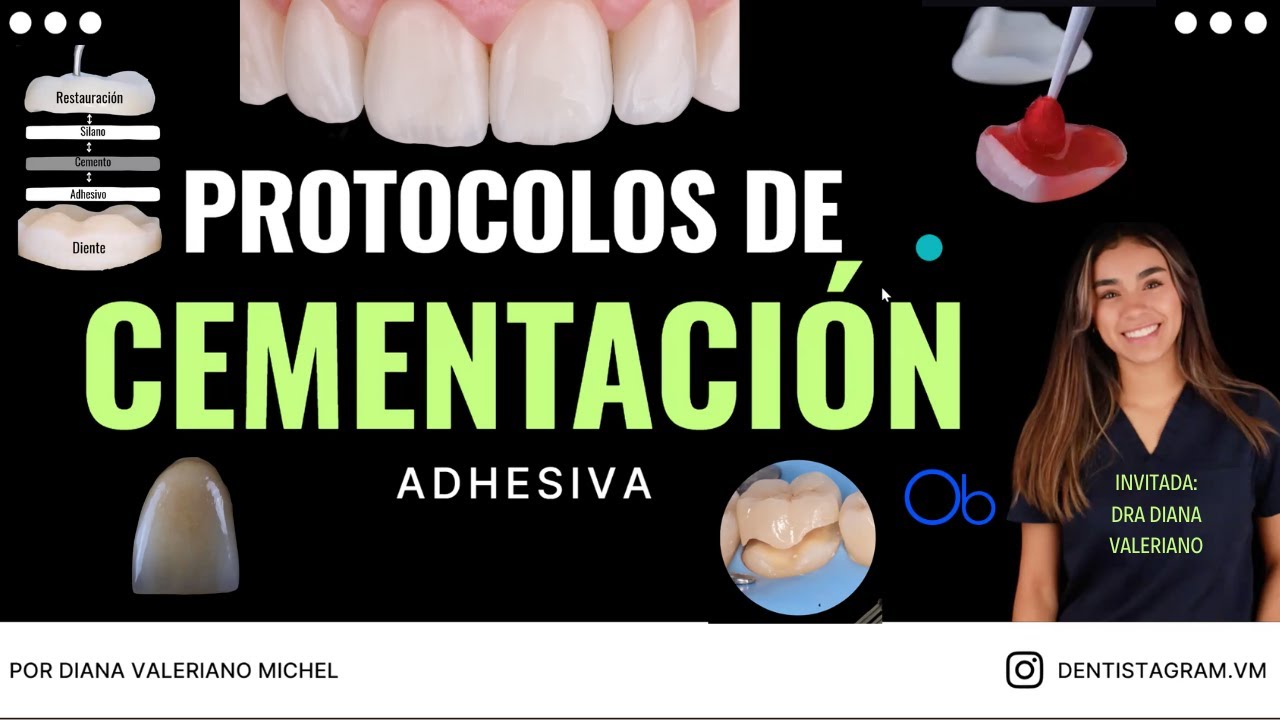 Protocolos de Cementación Adhesiva 🦷 con Dra Diana Valeriano