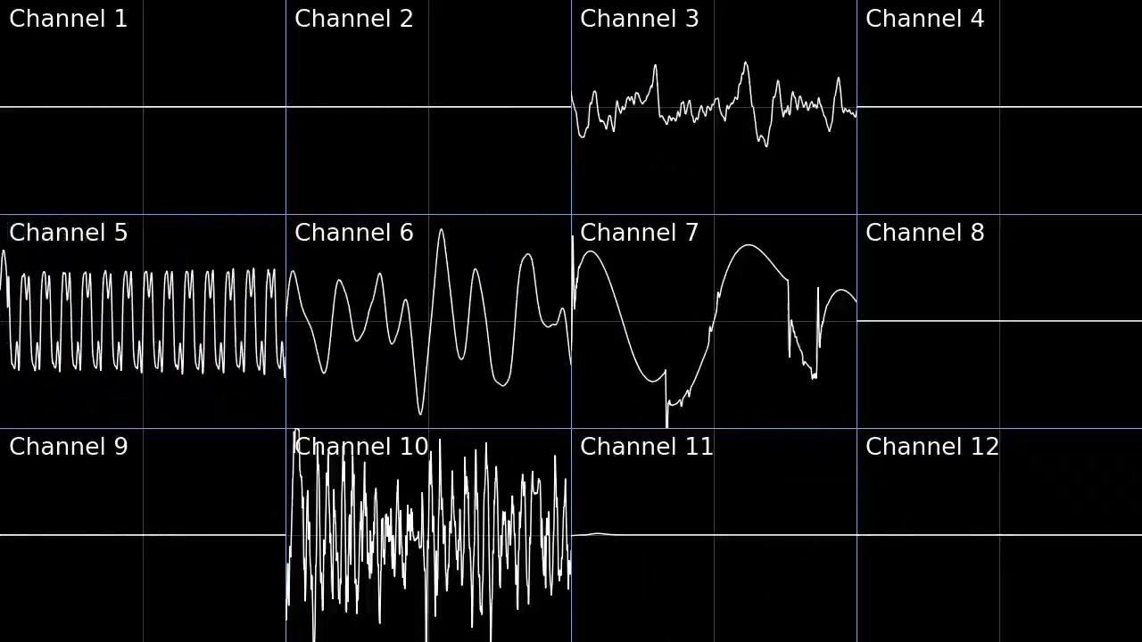 NSMBWii Volcano Theme Sonic 4 Remix
