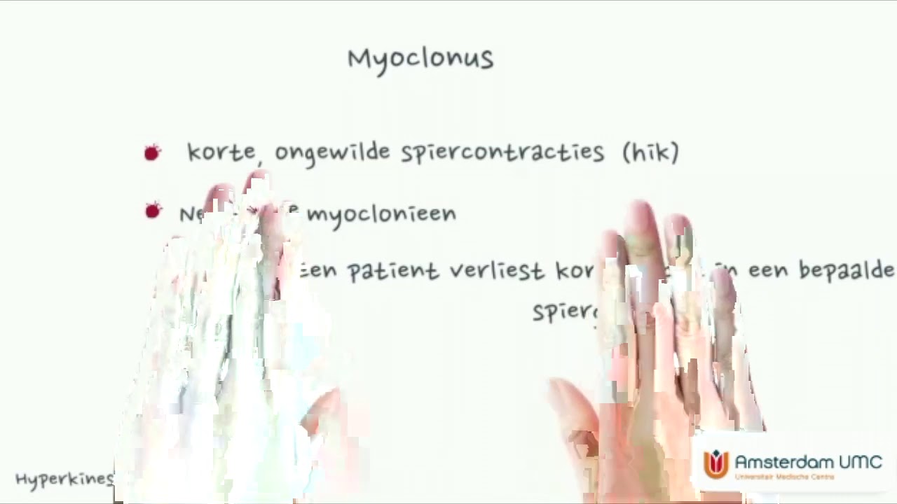 Hoe classificeer je bewegingsstoornissen?