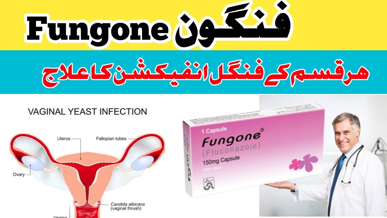 Uses, Side effects,Doses, Formula and Contraindications of Fungone Capsule ( Fluconazole)