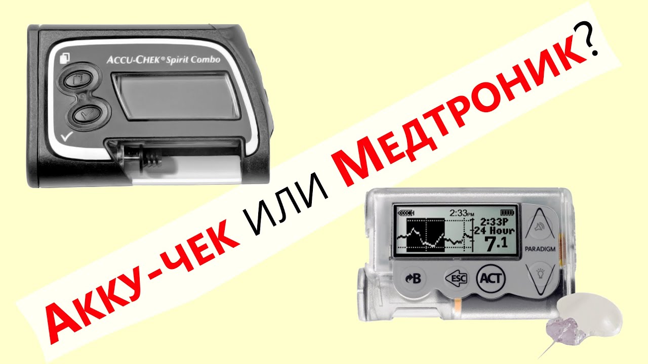 Какую инсулиновую помпу выбрать для неофициальной петли? / @mydialife