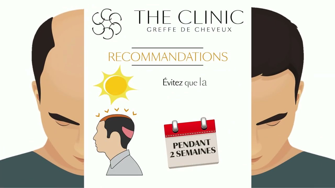 RECOMMANDATIONS POST OPERATOIRES GREFFE DE CHEVEUX - THE CLINIC