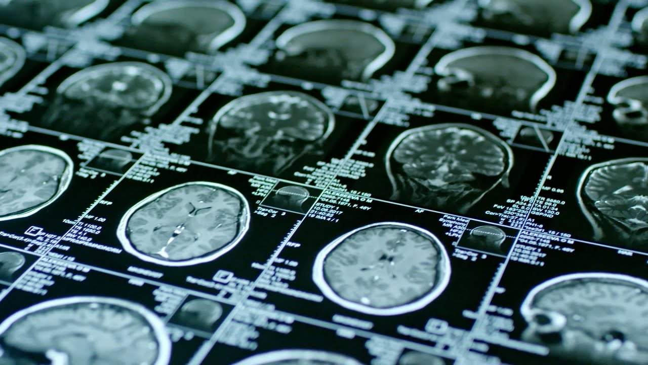 Rice at Davos | What Is the Brain Economy — And Why It Matters