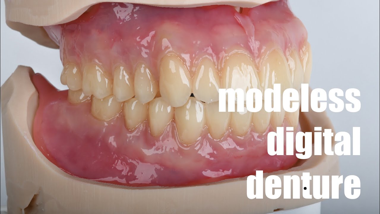 modeless Digital denture (feat. print & click)