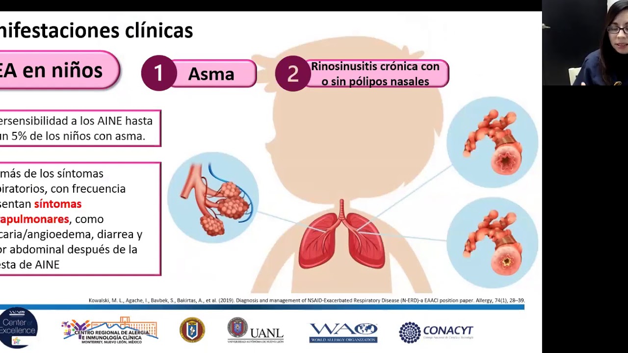 Enfermedad respiratoria exacerbada por AINE (EREA).