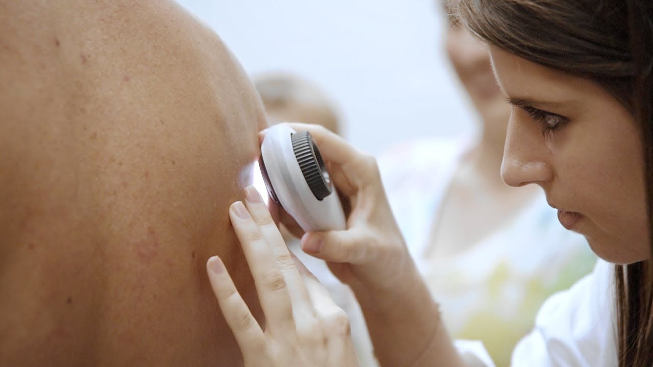 Chomp Melanoma hosts community skin cancer screening