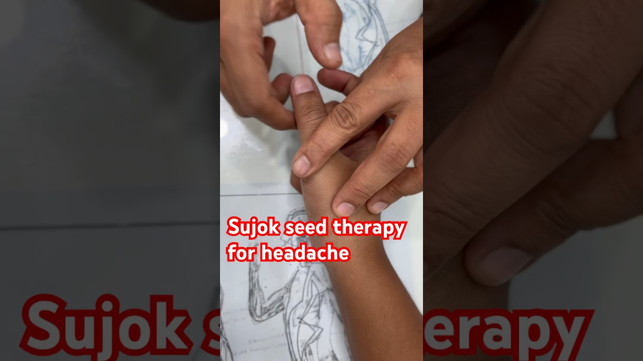 Sujok seed therapy for headache #sujoktherapy #seedtherapy #headacherelief #sujokpoints