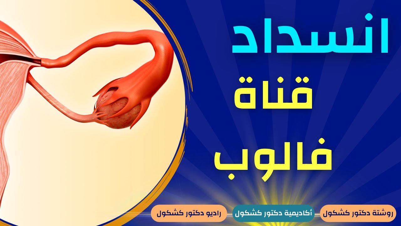 انسداد قناة فالوب: الأعراض، الأسباب، المضاعفات، وطرق العلاج الفعالة