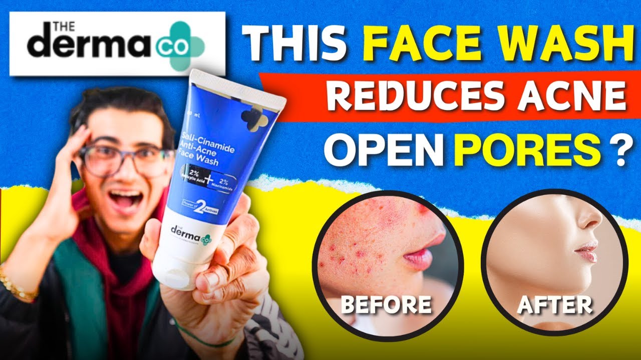 Say Goodbye to Skin Issues: Derma Co Sali Cinamide Face Wash Review
