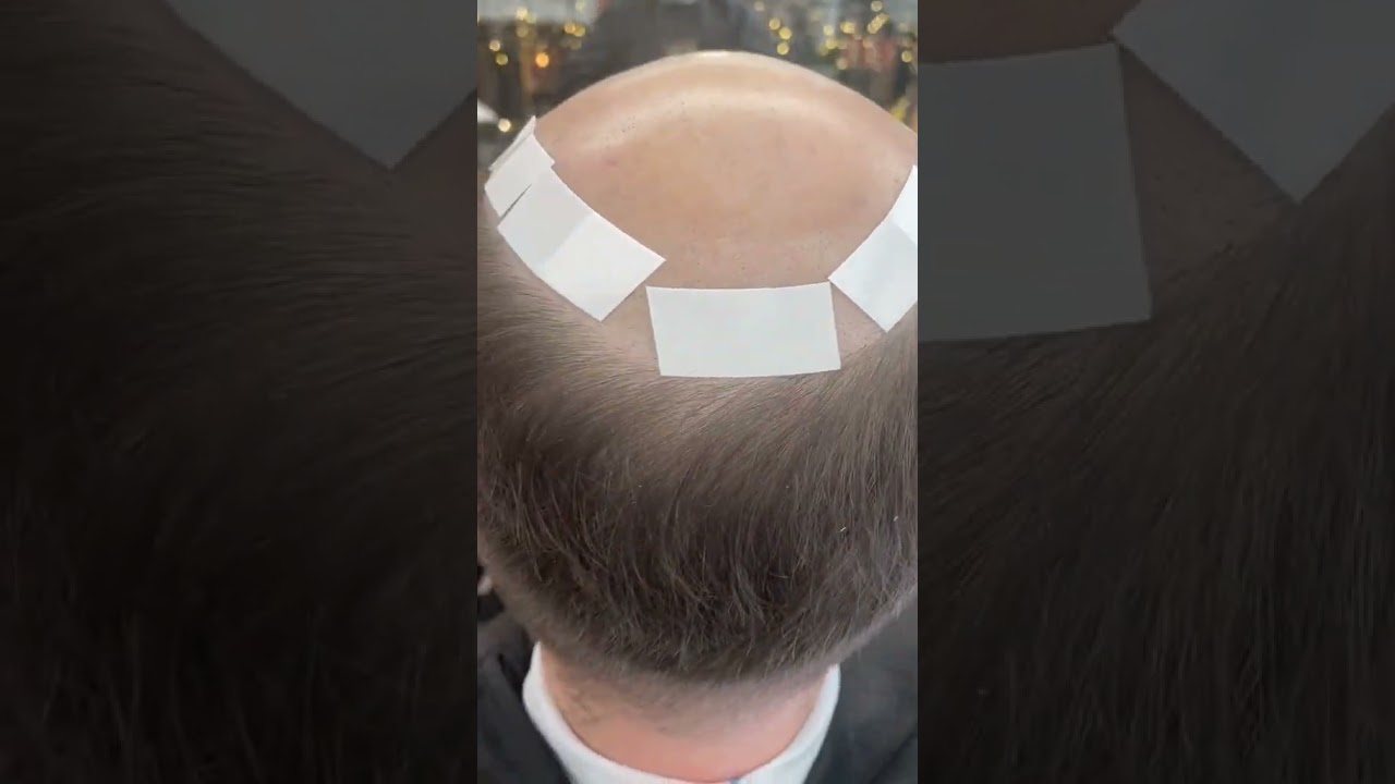 Hair System Fitting 101 | Step by Step Guide | Lavivid Hair System