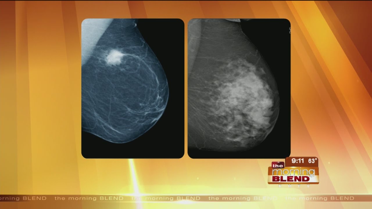 Dense Breast Awareness- Stay Informed
