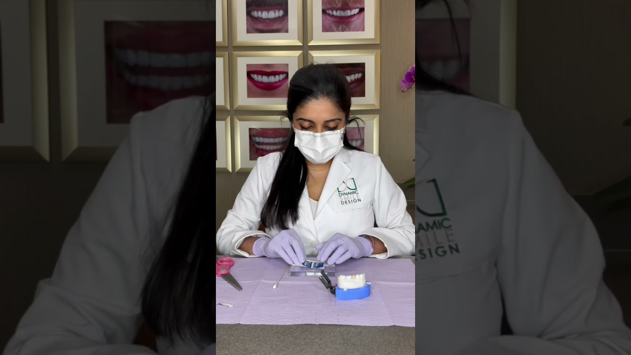 How to recement your temporary crown