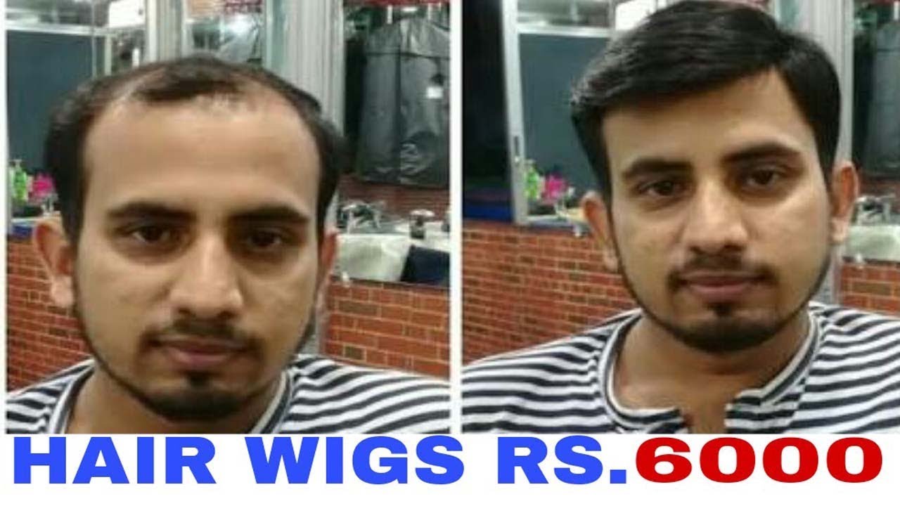 Hair wigs in delhi . Rs. 6000 . 9990115900 . Hair wigs in delhi . Hair wigs price in delhi  rohini