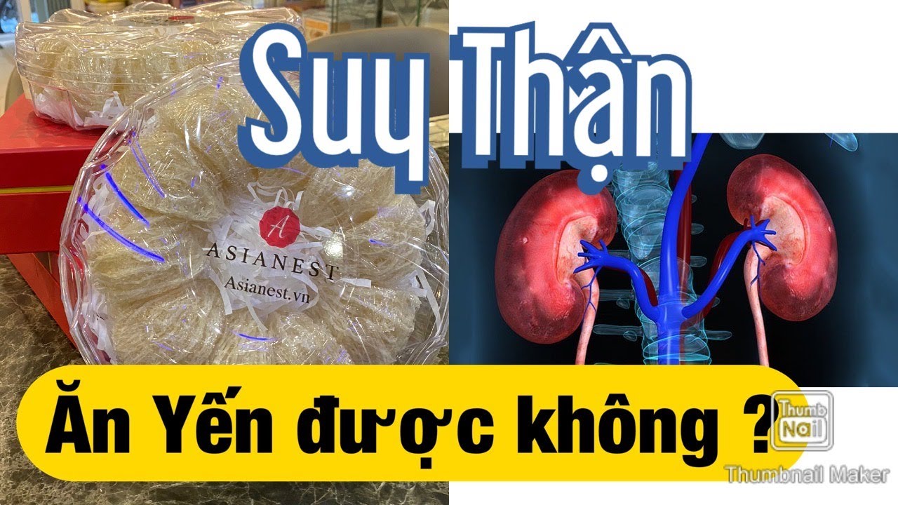 Suy Thận C&oacute; Ăn Tổ Yến S&agrave;o được hay kh&ocirc;ng ? Người bị Thận cần lưu &yacute; điều g&igrave; ?