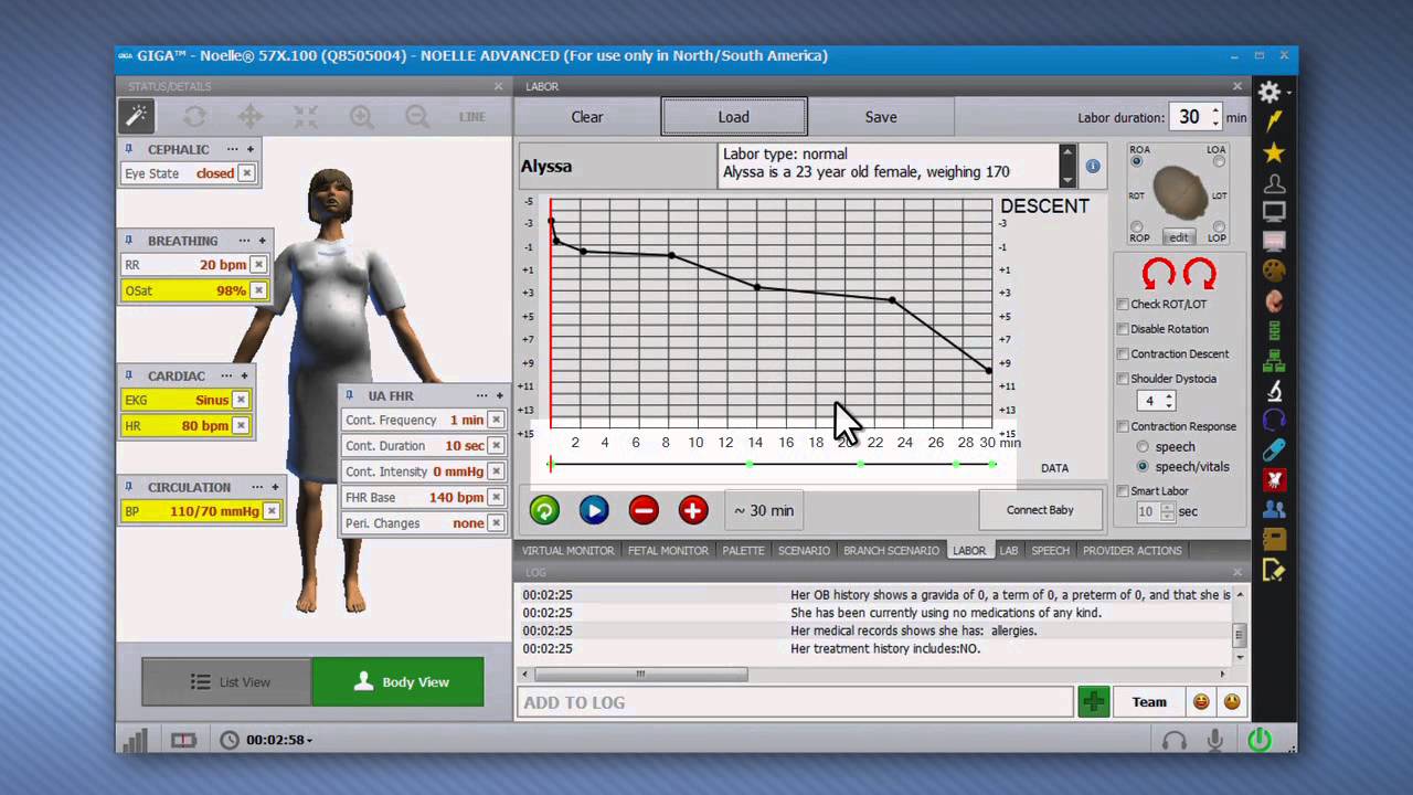 NOELLE S574.100 | S575.100 | S576.100 - GIGA Labor Scenarios - Part 9