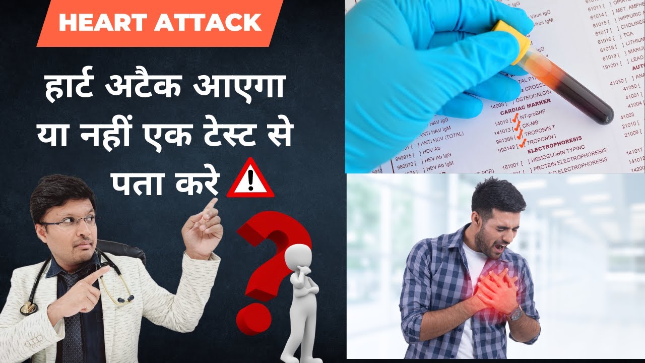 HSCRP: Role in Prediction of Heart Attack