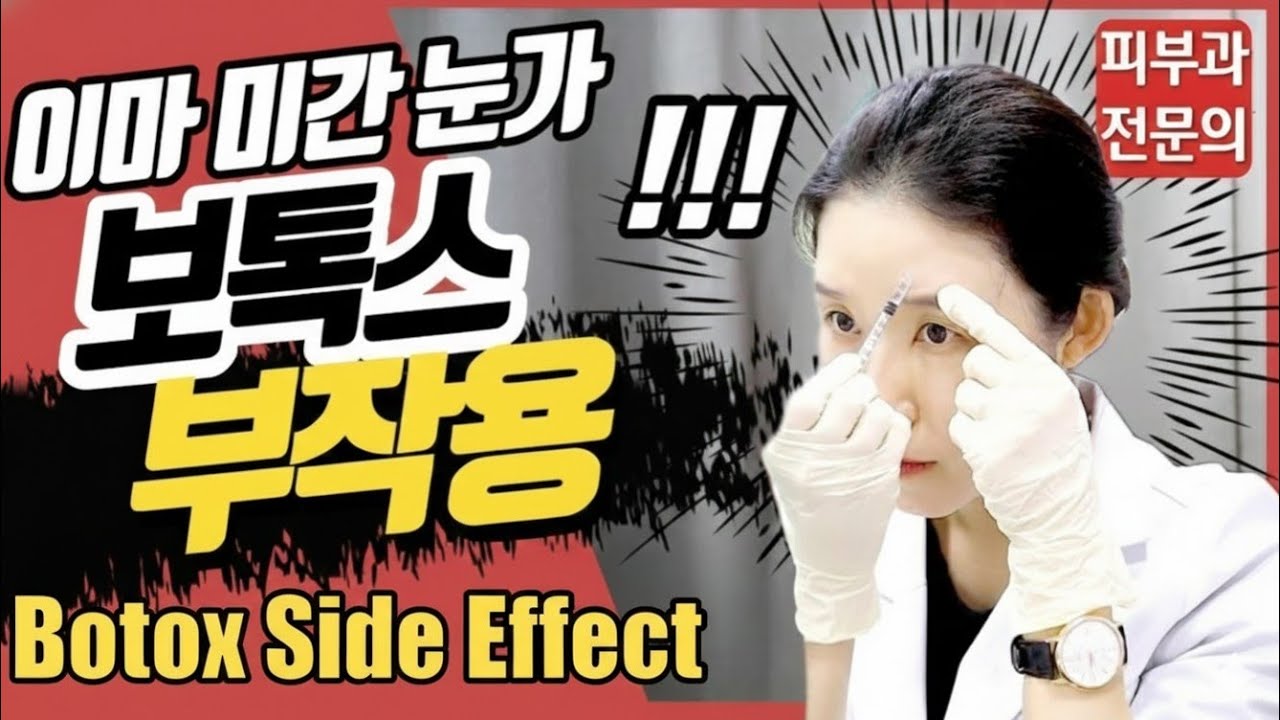 (Eng*) 보톡스 부작용 - 이마 미간 눈가주름 편, 셀프시술! Side effect of forehead, frownline, eye winkle botox - [닥터필러]