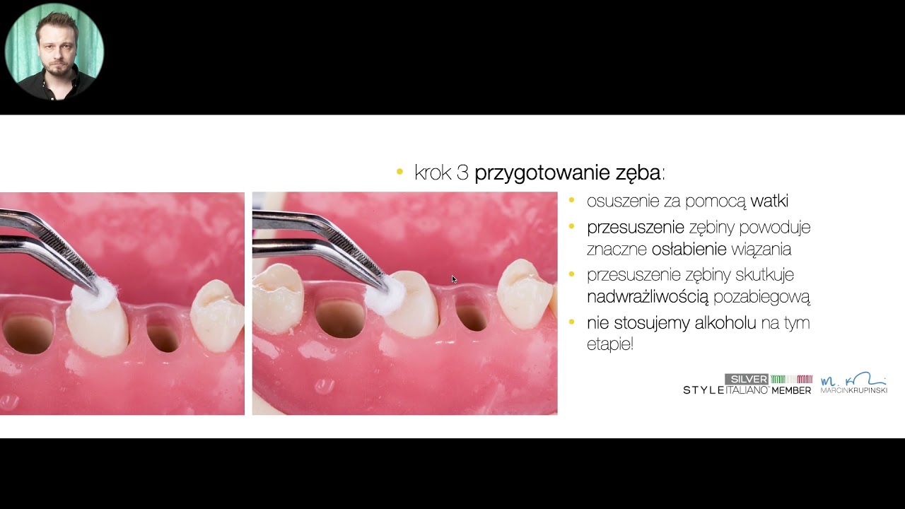 🎓 Kurs on-line: Cementowanie | cementowanie koron ceramicznych (lek. dent. Marcin Krupiński)