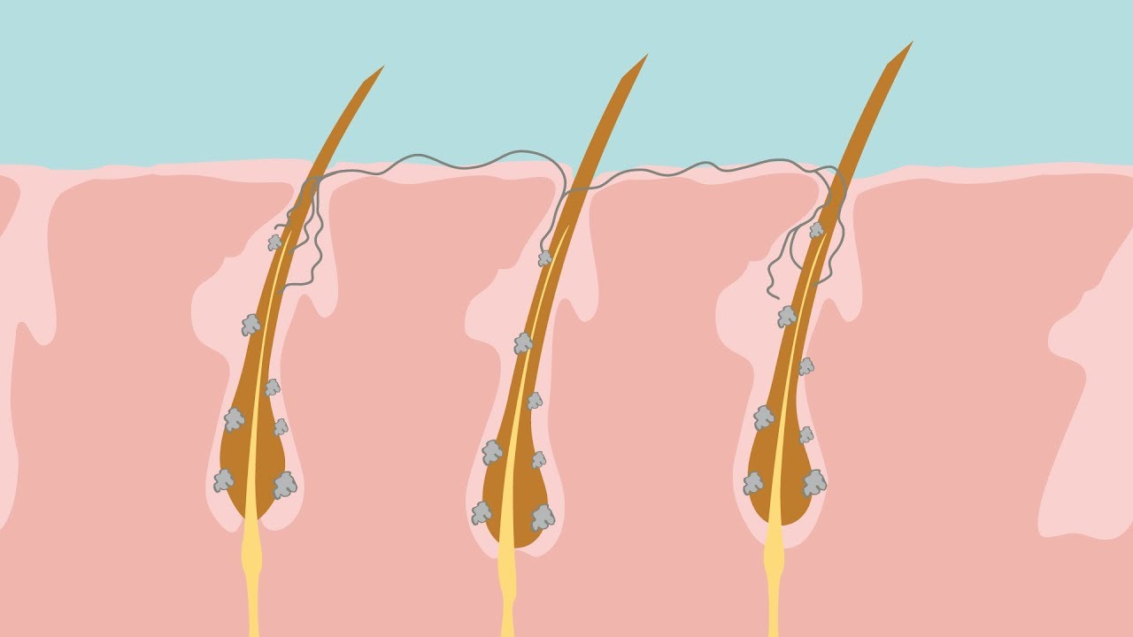 Micosi e dermatofiti, i funghi della pelle che colpiscono gli animali e l’uomo [video]