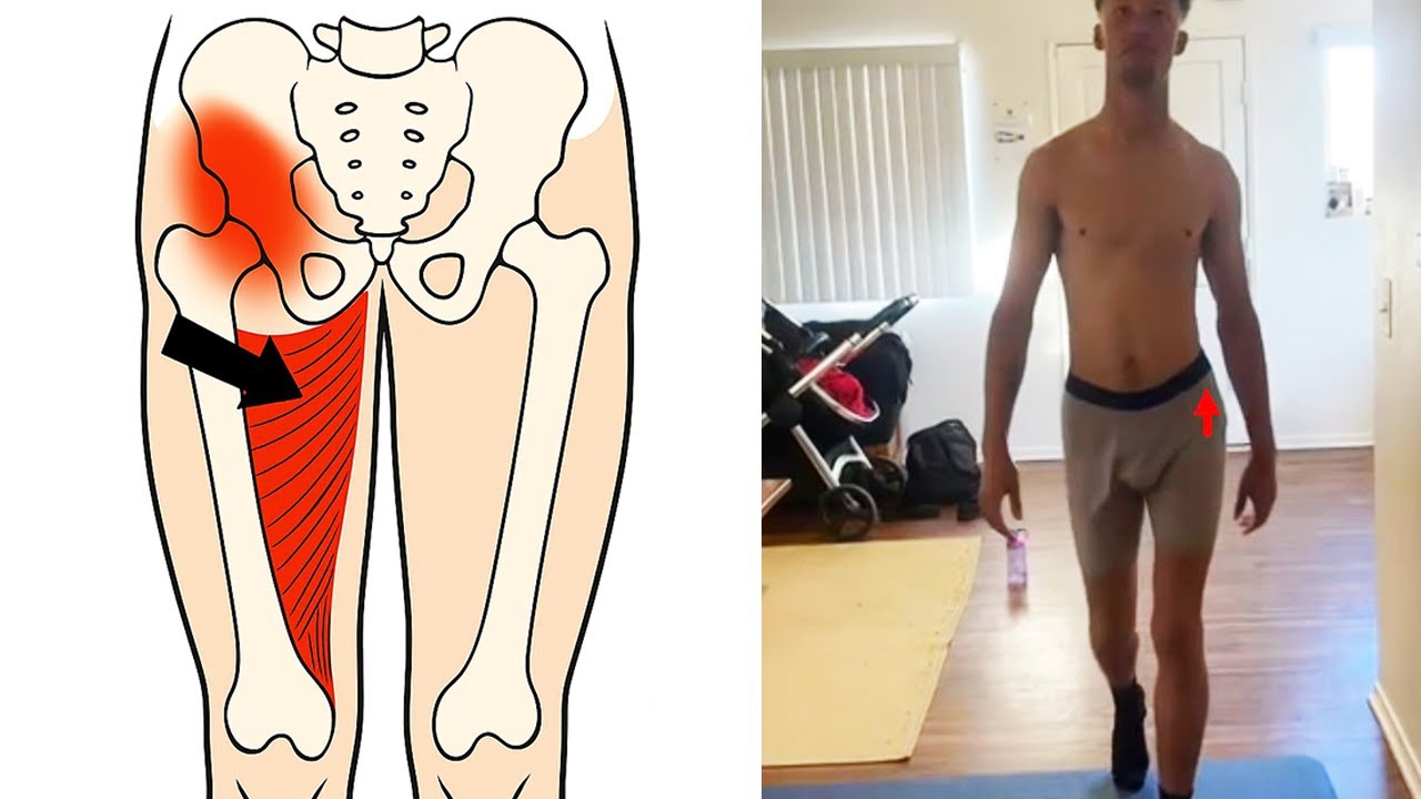 How to fix Groin & Adductor Pain (Left AIC pattern exercises)