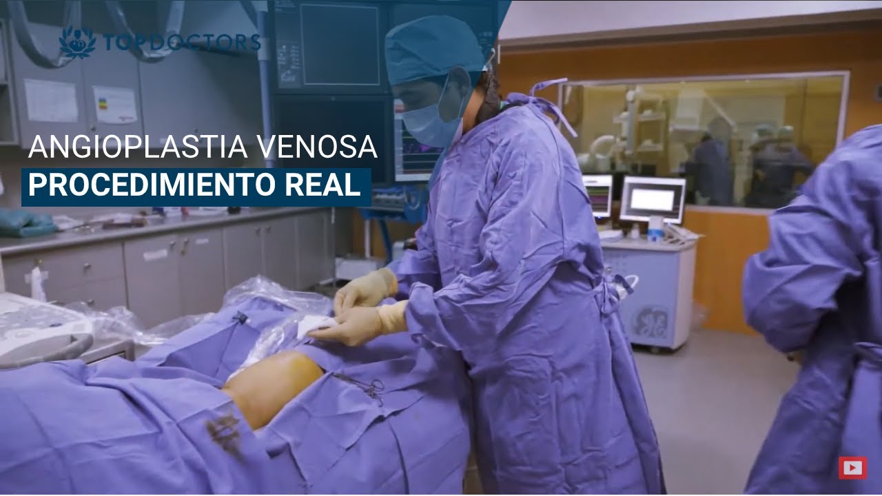 Procedimiento: Angioplastia Venosa con balón stent (CASO REAL)