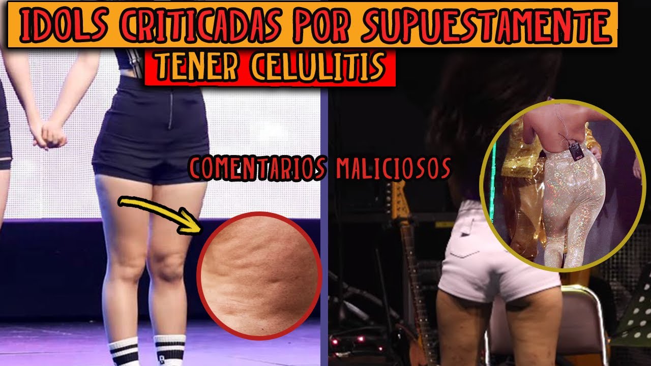 Idols CRITICADAS por supuestamente tener CELULITIS