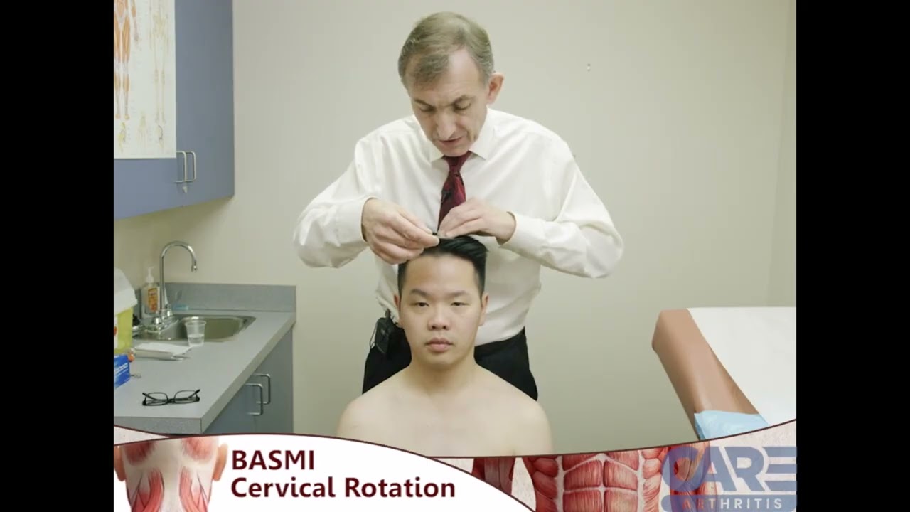 BASMI Cervical Rotation (English Original)
