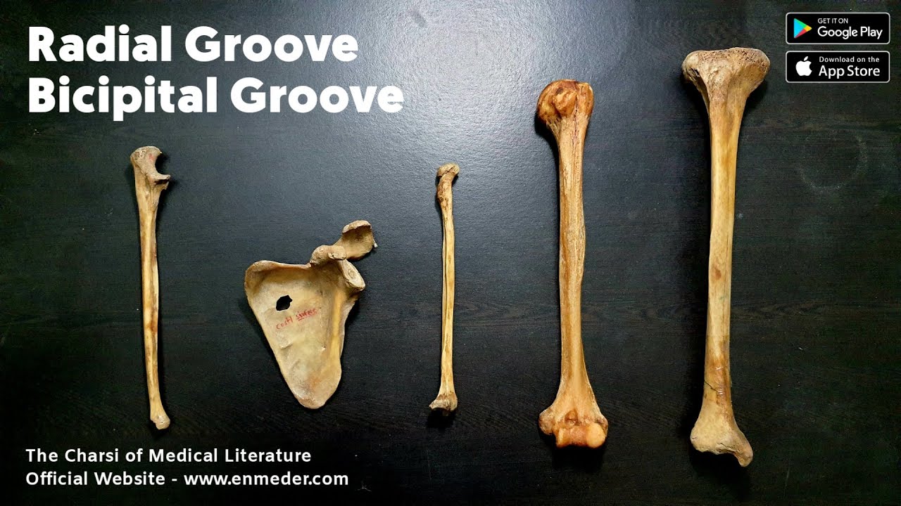 Radial Groove v/s Bicipital Groove | The Charsi of Medical Literature