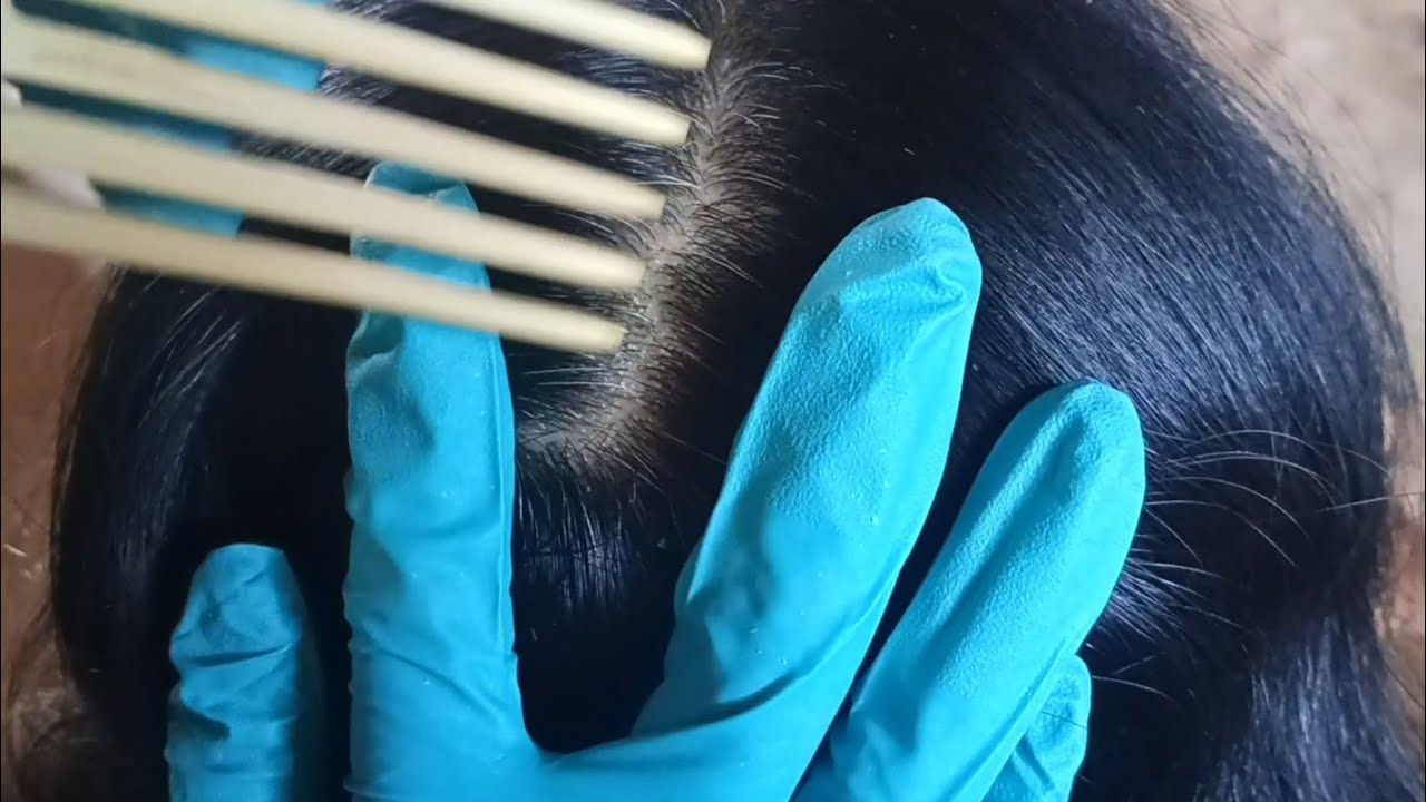 ASMR: Scratching Dandruff &Relaxing Hair Play