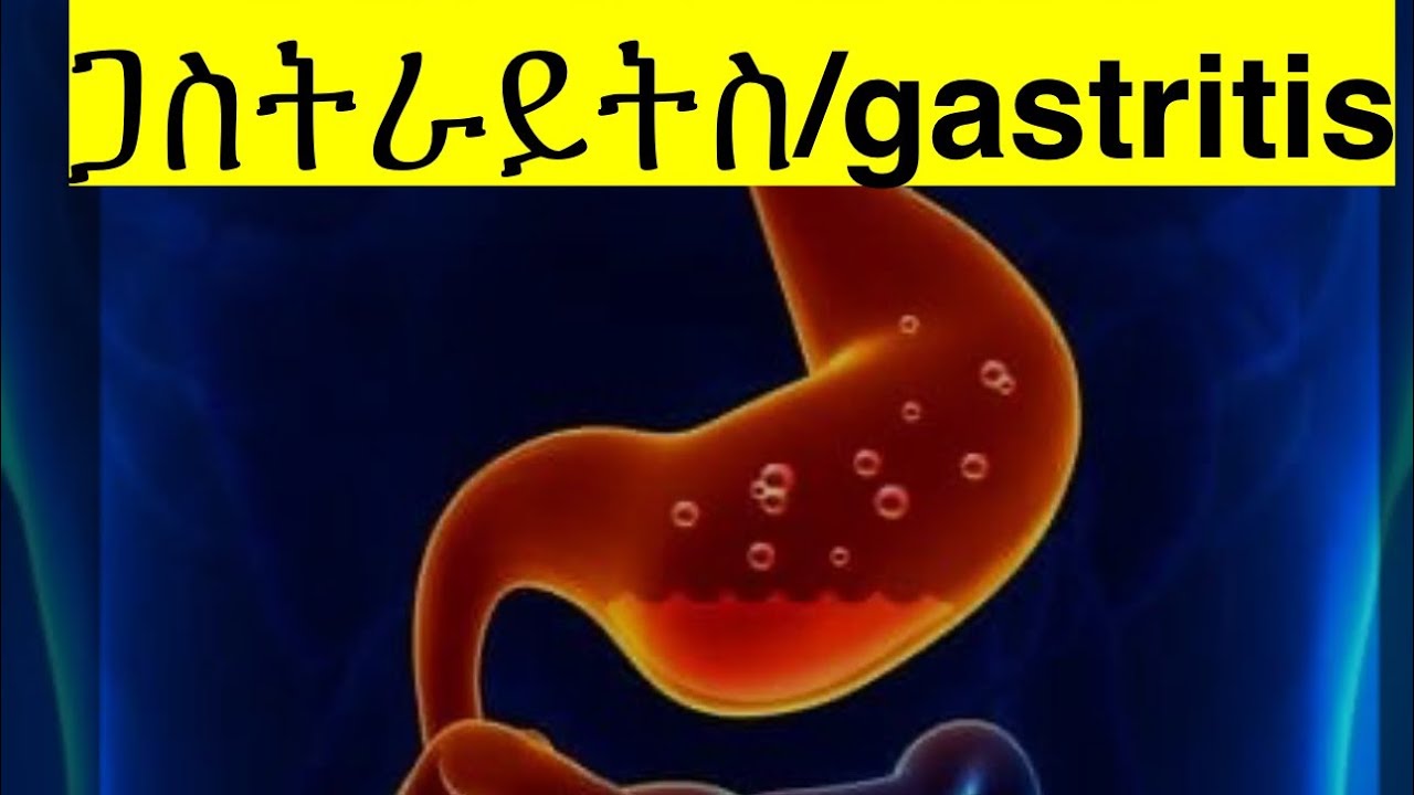 ሕማም ጋስትራይትስ (ቁጥዐ ከስዐ) || Gastritis explained in Tigrinya