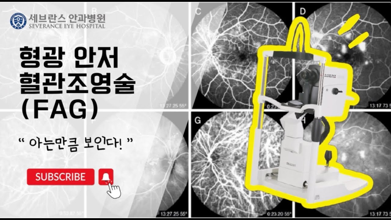 안과 검사 안내영상 - 형광 안저 혈관조영술(FAG)