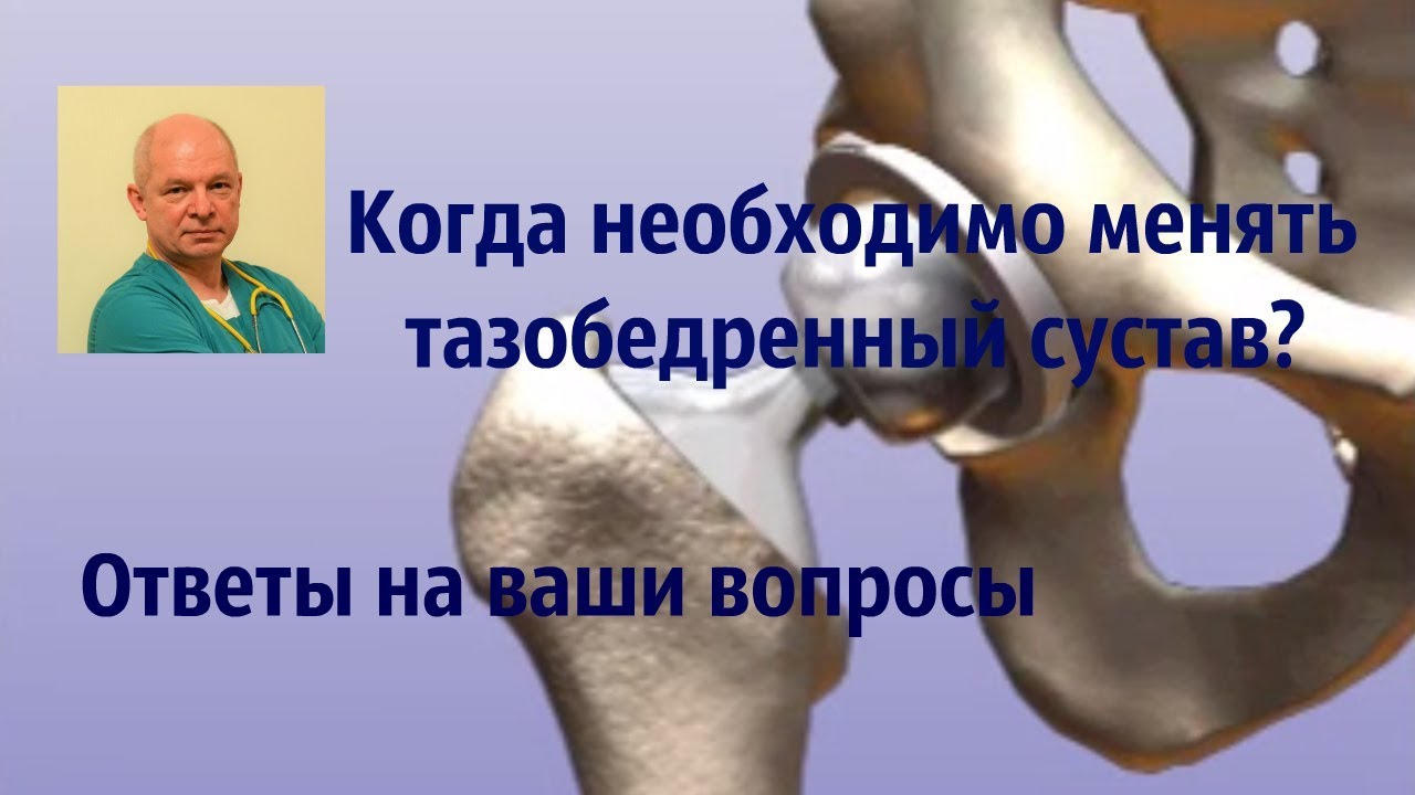 Когда необходимо менять тазобедренный сустав? Ответы на ваши вопросы.