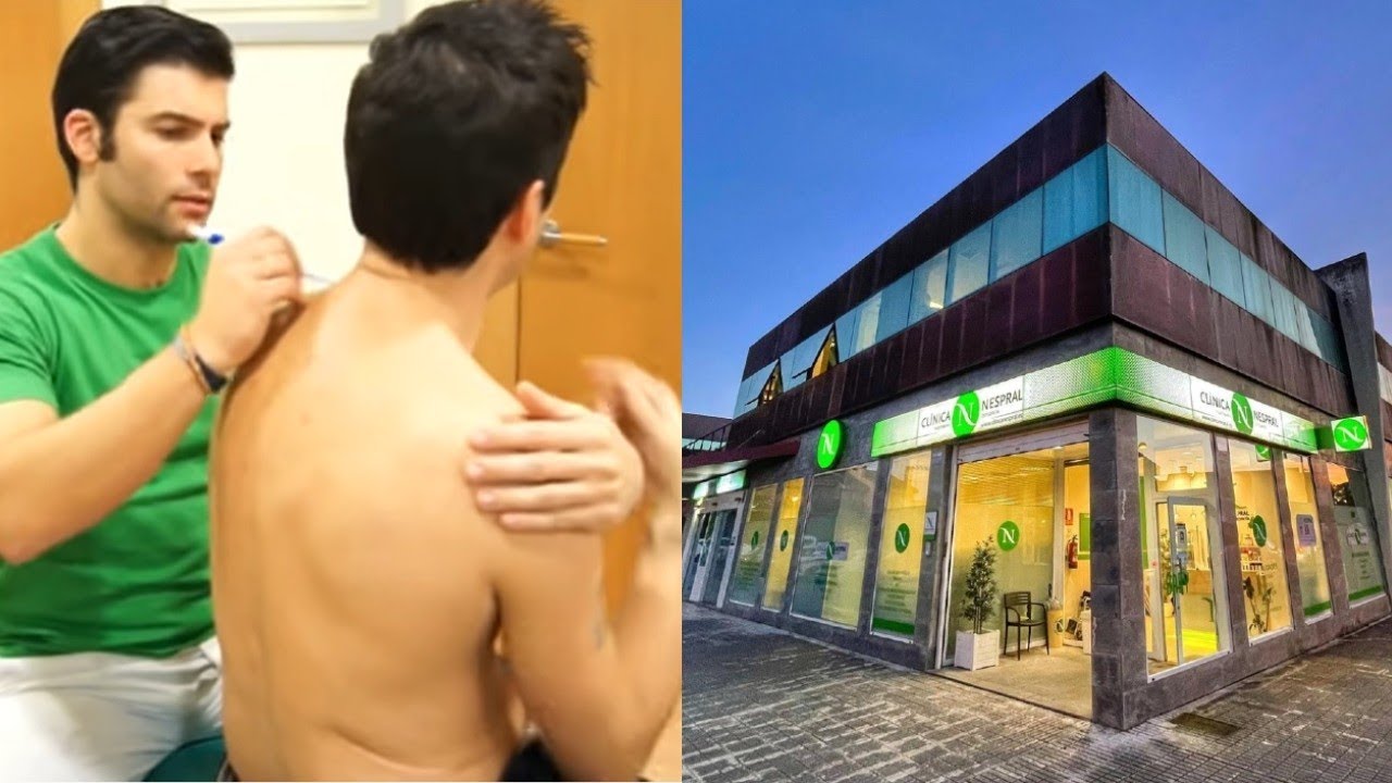 I PARTE CERVICALGIA FISIOTERAPIA OSTEOPATIA CLINICA NESPRAL.avi
