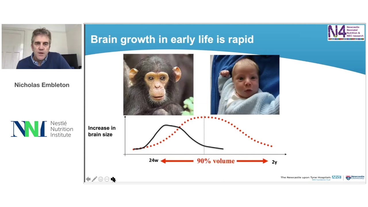 Word Prematurity Day 2020 - Ten key concepts in Neonatal Nutrition, by Nicholas Embleton