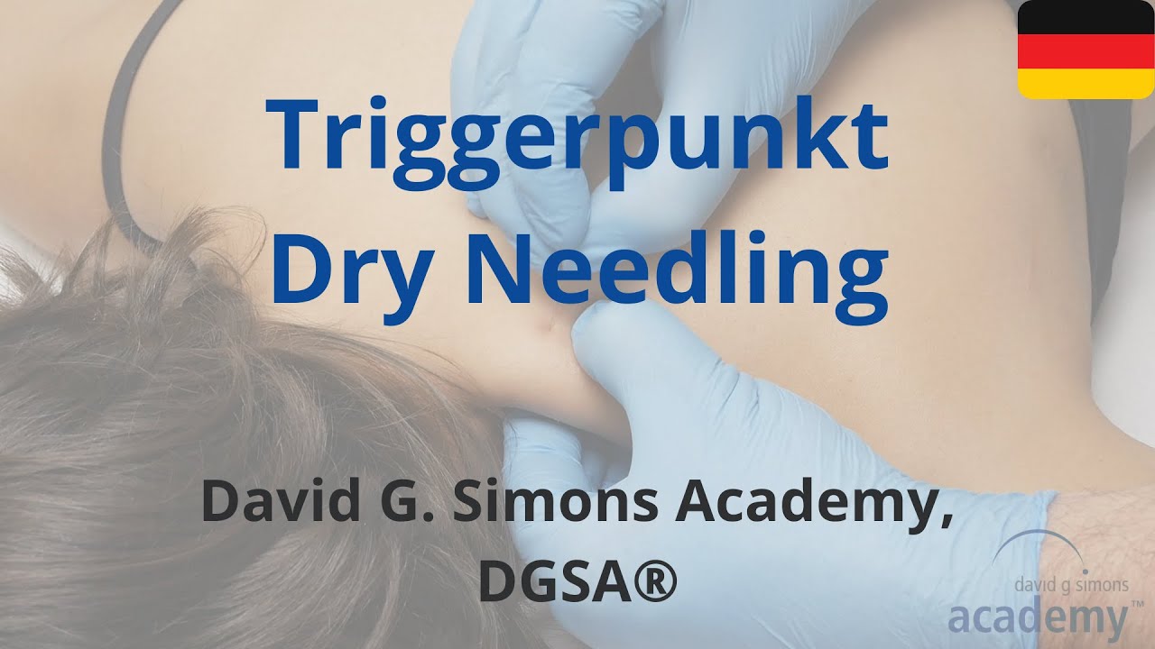 Triggerpunkt Dry Needling