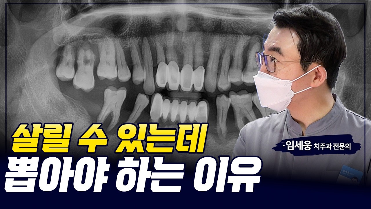 살릴 수 있는 치아를 왜 뽑으라고 할까? #임플란트 #전체임플란트 #풀아치임플란트