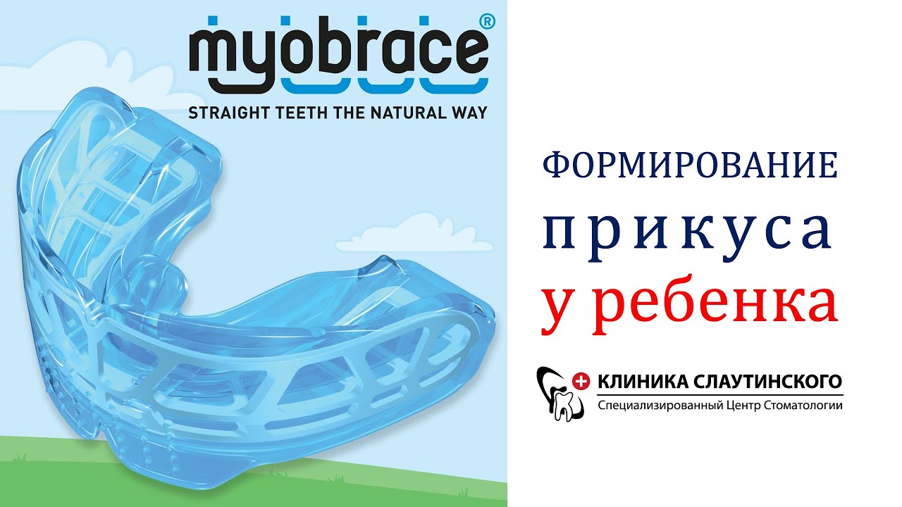 Как сделать зубы ровными. Система Myobrace