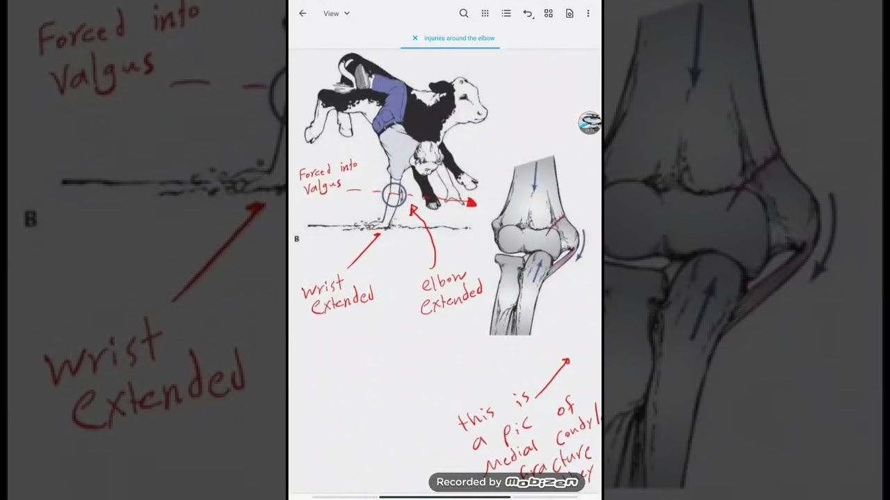 upper limb elbow part 2