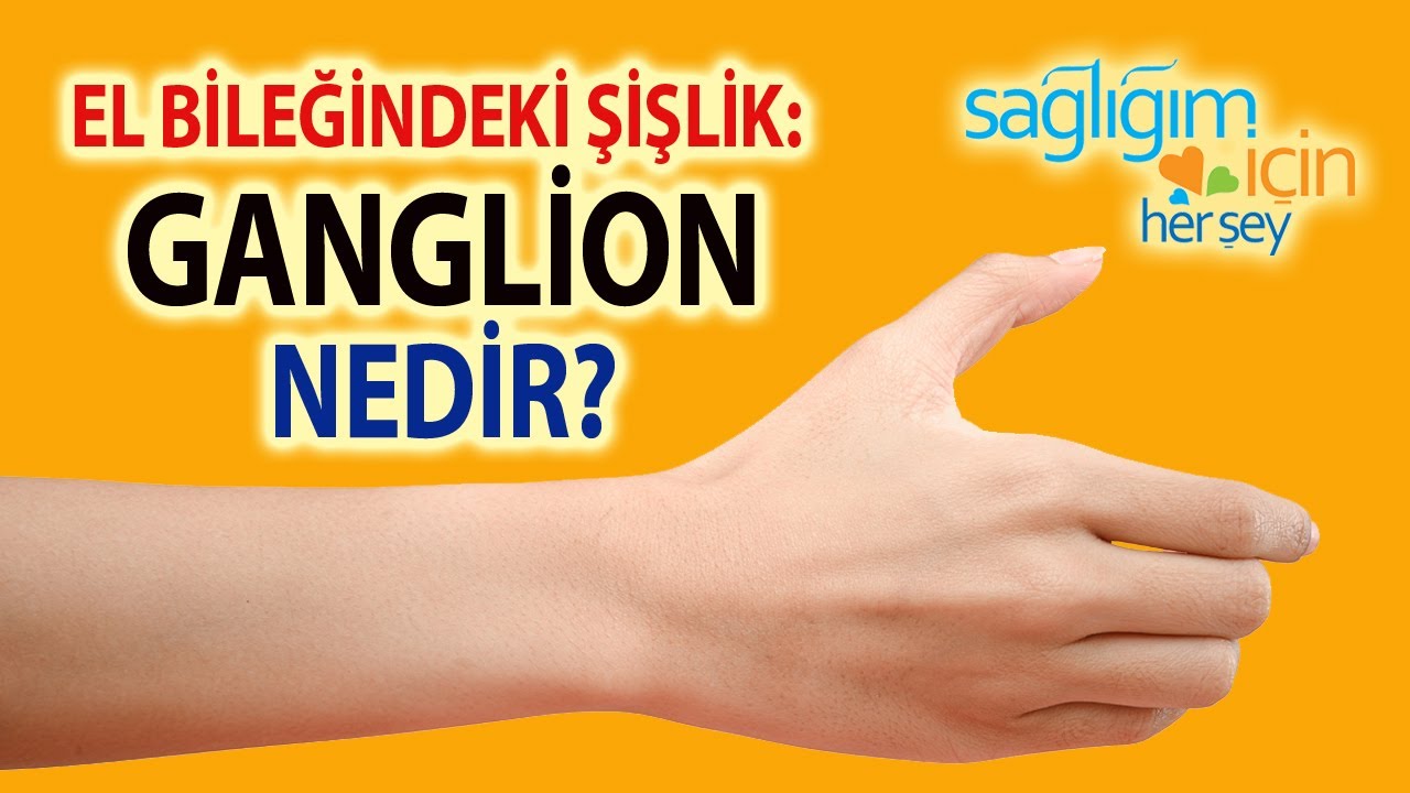 El Bileğindeki Şişlik: Ganglion Nedir?