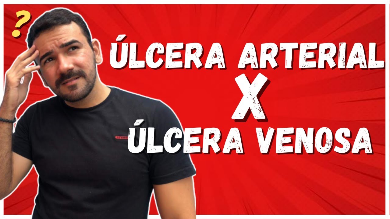 🔴Aprenda a Diferença entre a Ulcera Venosa e Ulcera Arterial I Aula COMPLETA