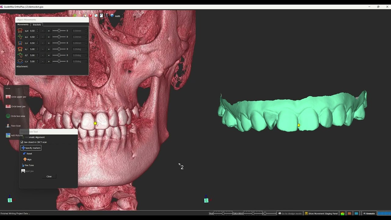 GuideMia OrthoPlus CBCT manual registration