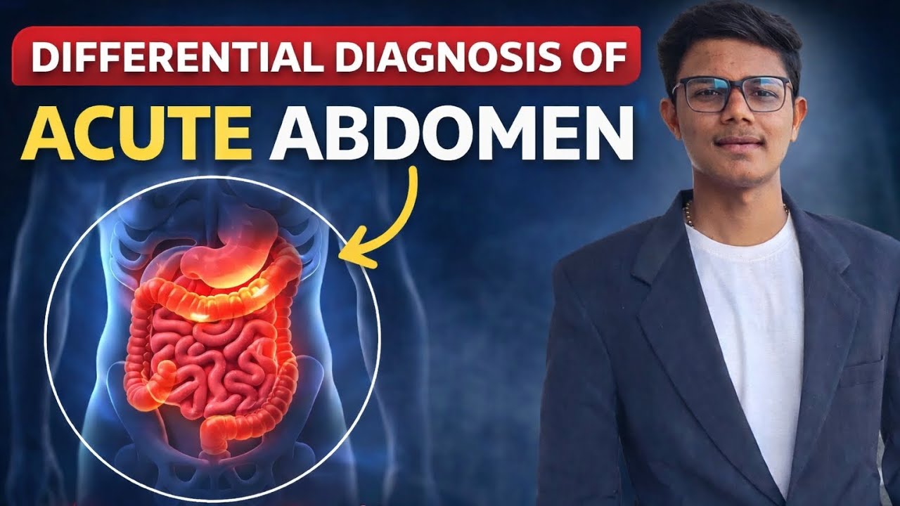 Differential Diagnosis of Acute Abdomen | Definition, Diagram & D/D Explained