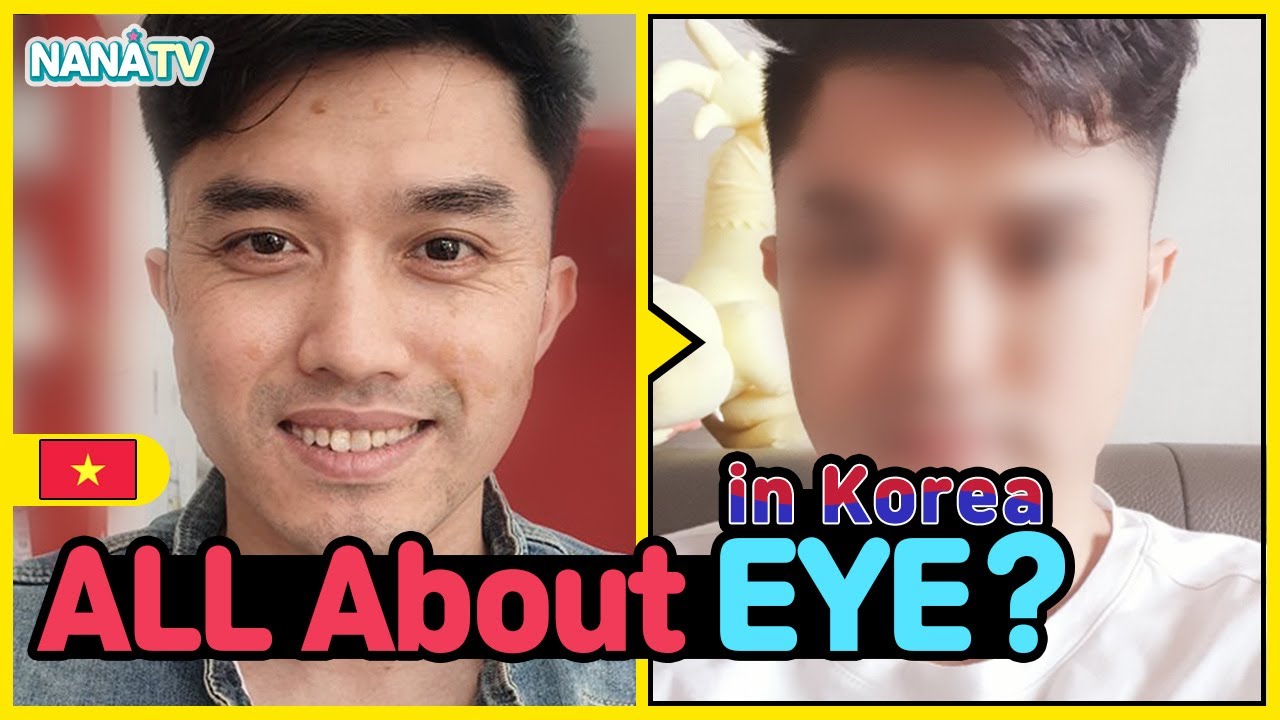 [7-1] Male eye lift, Blepharoplasty before and after | Double eyelid surgery Korea vlog 🐸
